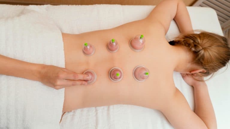 Cupping Therapy: Role in Effective Stress Management